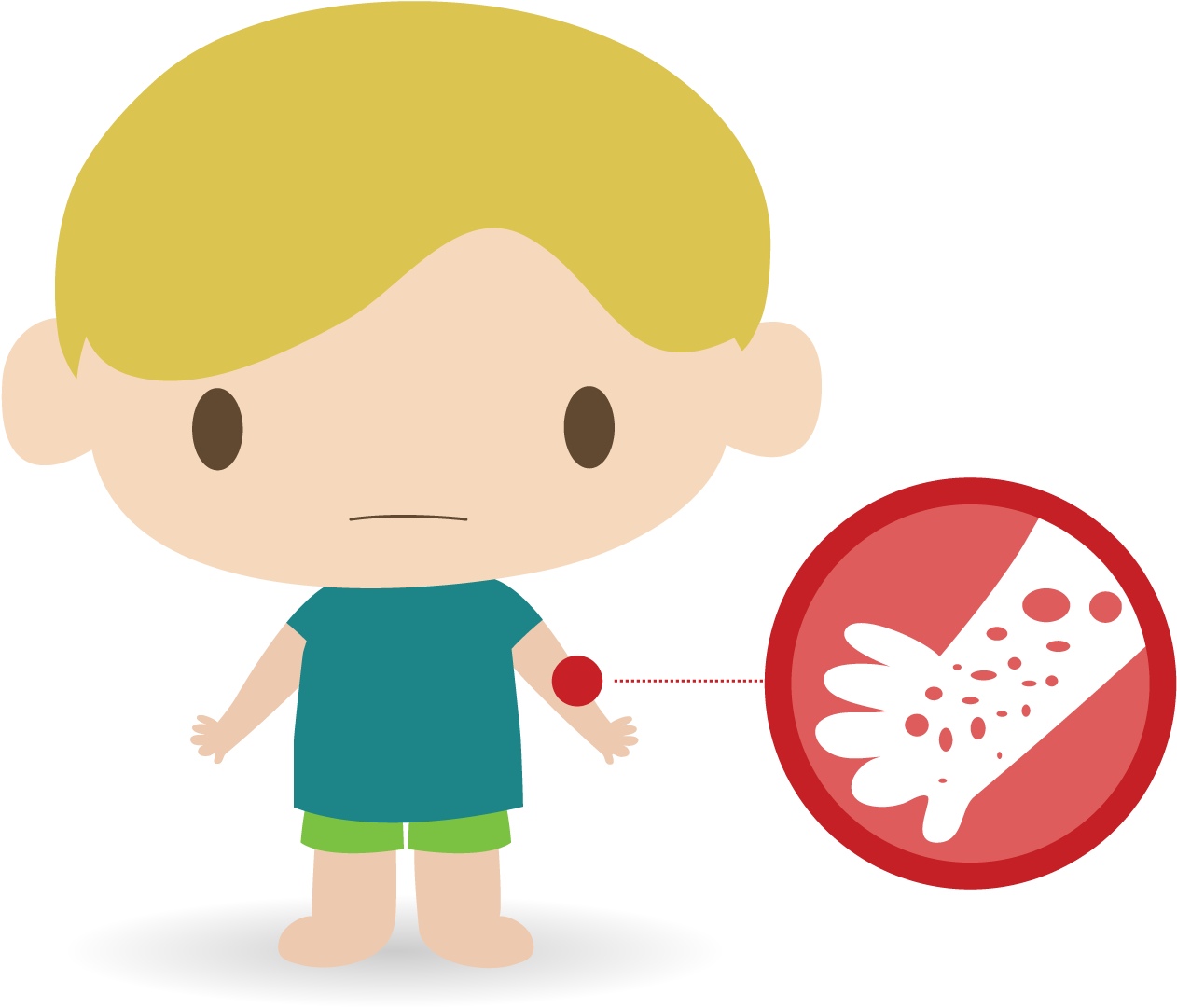 Rashes - Rash Png (1420x1080)