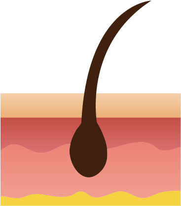 Hairfolice - Hair Loss (624x625)