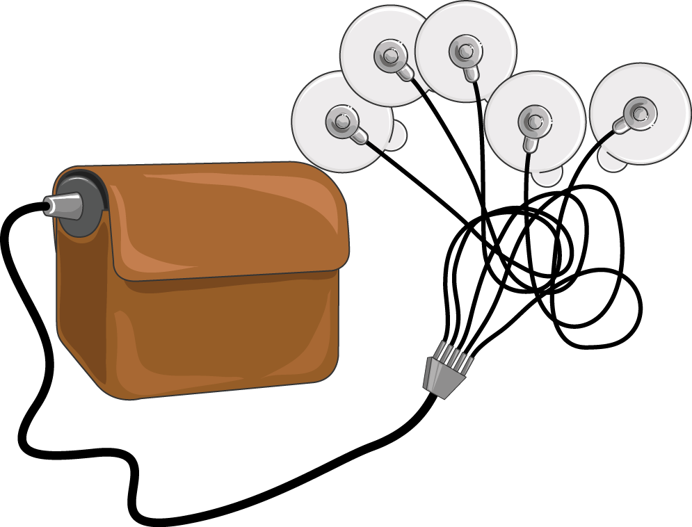 Holter Monitor - Holter Monitor Clip Art (995x758)