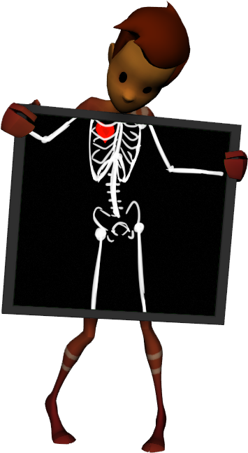 Is That I Have Bone-itis - Illustration (387x677)