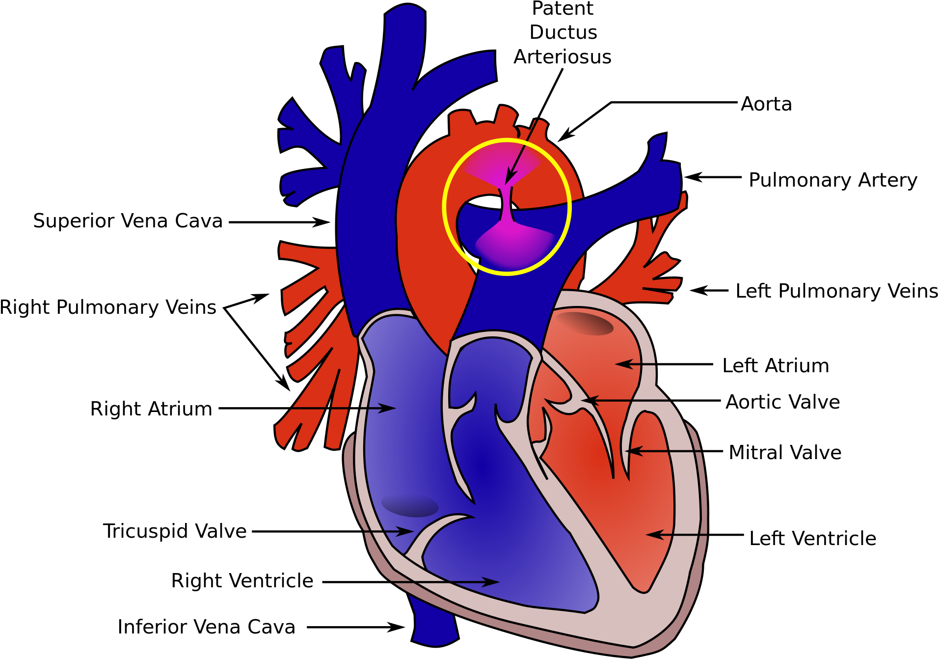 Real Human Heart 19, - Ductus Arteriosus And Ligamentum Arteriosum (2000x1432)