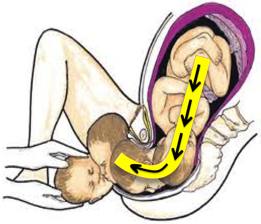 Giving Birth On Your Back Is Just Not Cool Pregnancy - Giving Birth On Back (878x894)