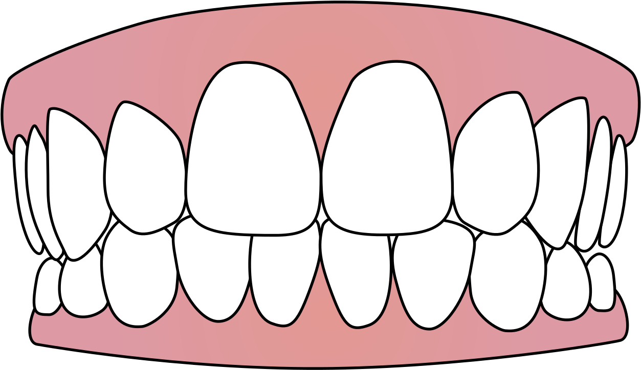 Human Tooth Computer Icons Clip Art - Teeth Icon (1280x727)