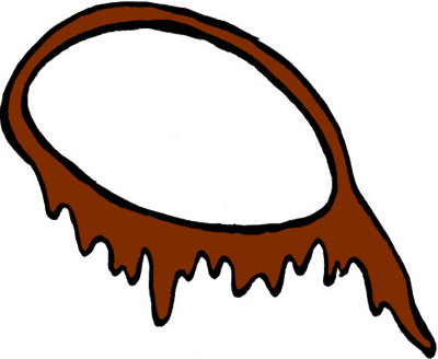 There Was A Kidnapping And Dianne Got Taken - Canula Nasofaringea (400x328)