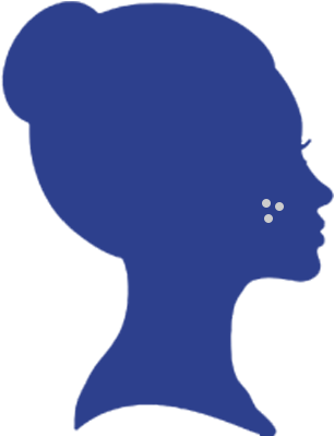 When I Need To Visit Dermatologist For Acne Treatment - Acne Icon (345x416)