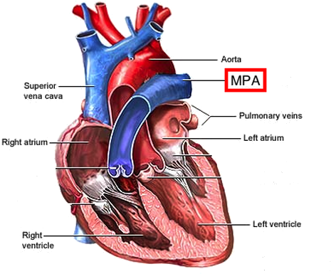 Blood Flow In The Arteries - Funny Funny Funny Rectangle Sticker (480x384)