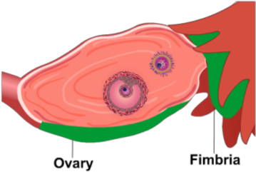 Ovary Fimbria - Illustration (420x420)