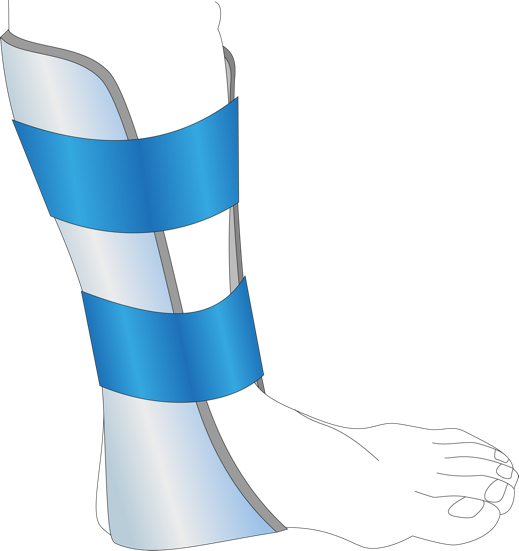 The Prometheus Omni Splint Is Also Now Available To - Splint Clip Art (519x551)