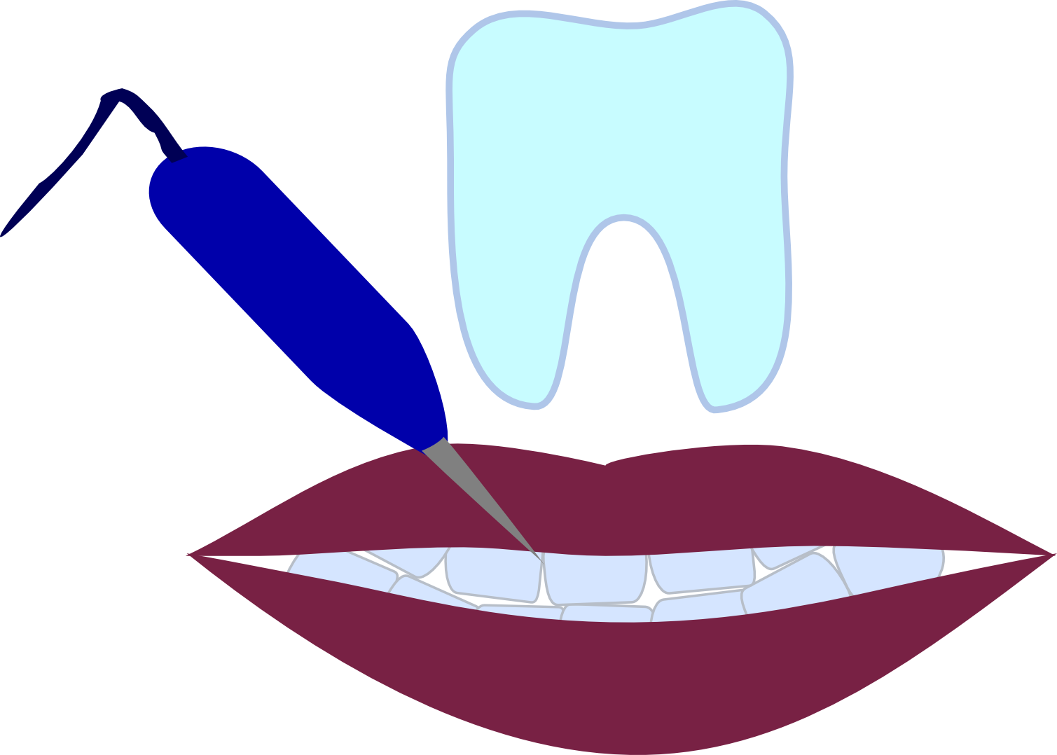 Tooth Line Clip Art - Tooth Line Clip Art (1509x1078)