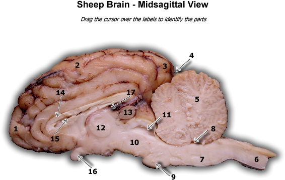 Human Anatomy Physiology 1 - Bratwurst (600x575)