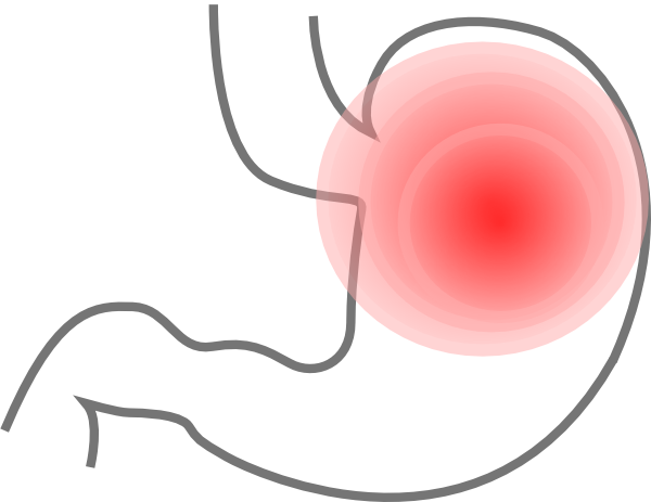 Stomach Clip Art - Stomach Clipart (600x463)