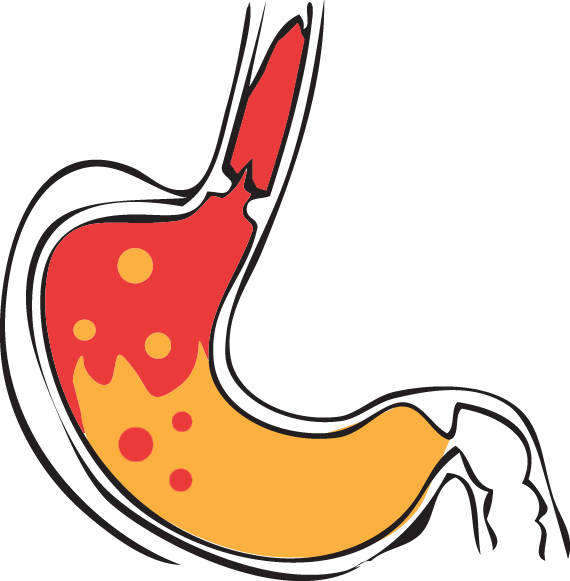 Gastric Acid Stomach Pepsin Hydrochloric Acid Clip - Stomach Acid Png (570x581)