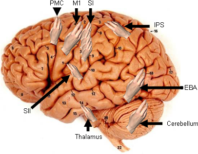 Indeed, We Know Of Multiple Representations Of The - Como Afecta La Fiebre Reumatica En El Cerebro (451x321)