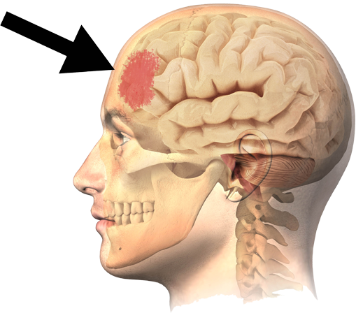 Oversleeping Causes Blunt Brain - Head Skull Brain (509x448)