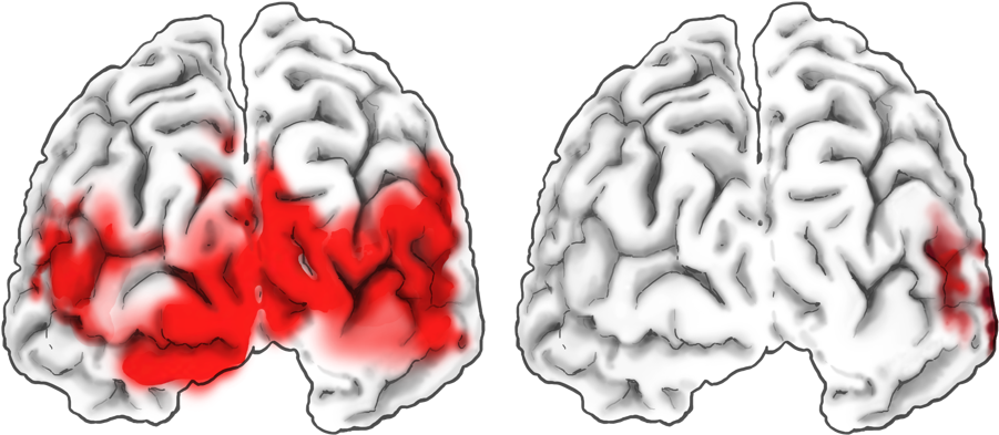 Foundation Text Neuroimaging Visualizing Brain - Illustration (989x526)