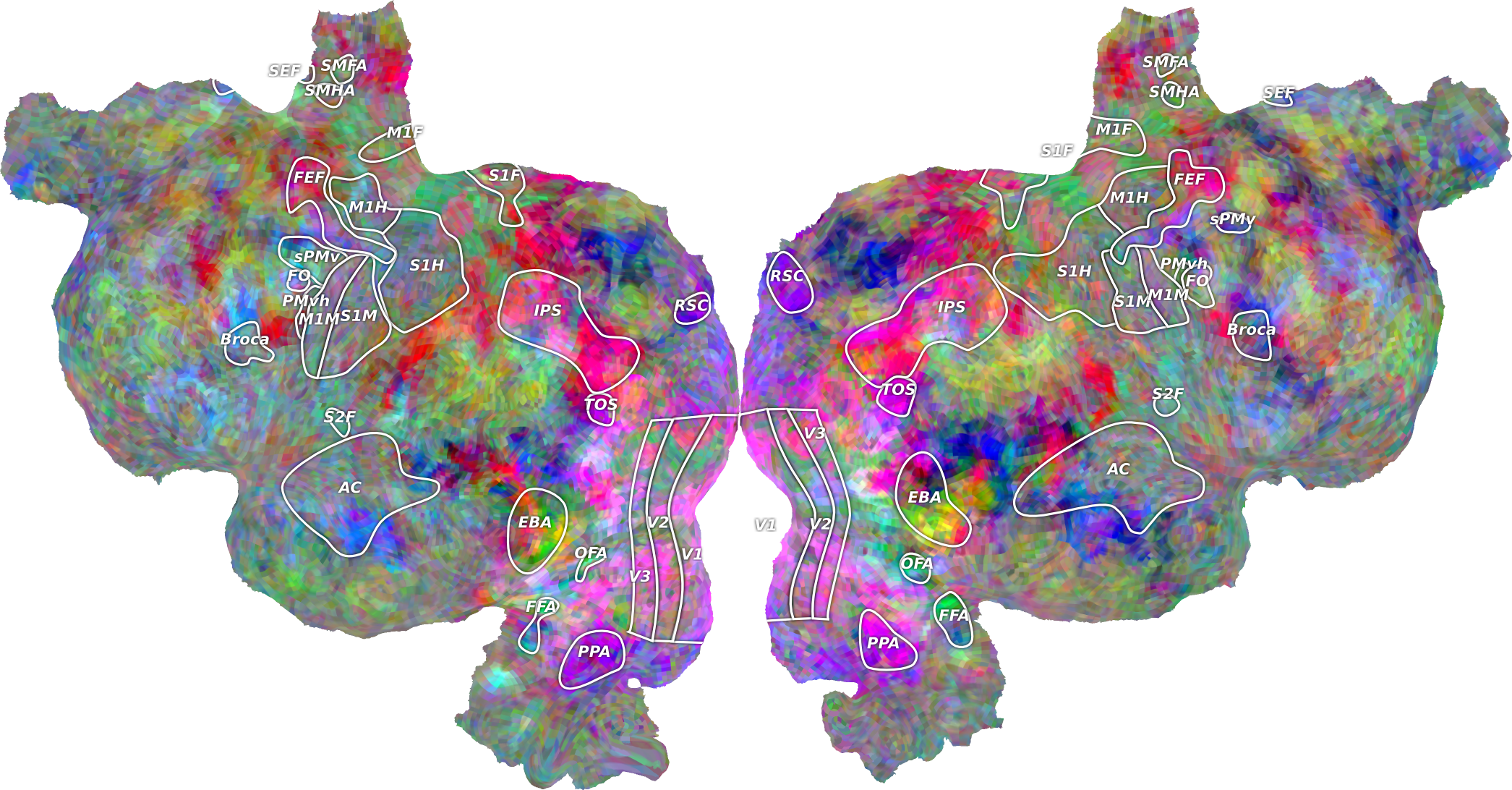 Quickflat Demo - Flattened Brain (2091x1092)