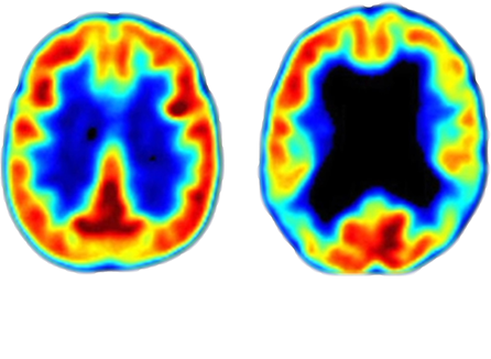 Memory Repair Protocol By Martin Reilly - Corner Office To Alzheimer's [book] (446x326)
