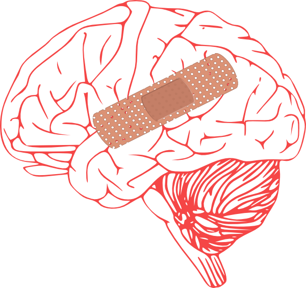Brain Injury Clip Art At Clker - Stroke Clipart (600x564)