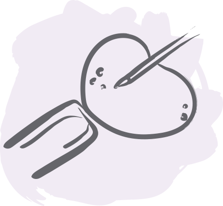 What Are Ivf Treatments - In Vitro Fertilisation (454x419)