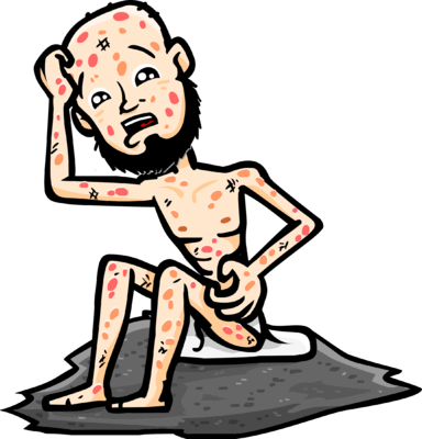 Tuesday, 28 February - Boils Clipart (384x400)