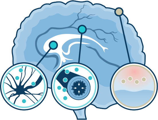 Treximet Is A Prescription Treatment Approved By The - Treximet Is A Prescription Treatment Approved By The (552x418)