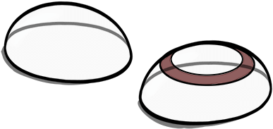 Contact Lens Cases Must Be Cleaned Regularly And Replaced - Circle (500x256)