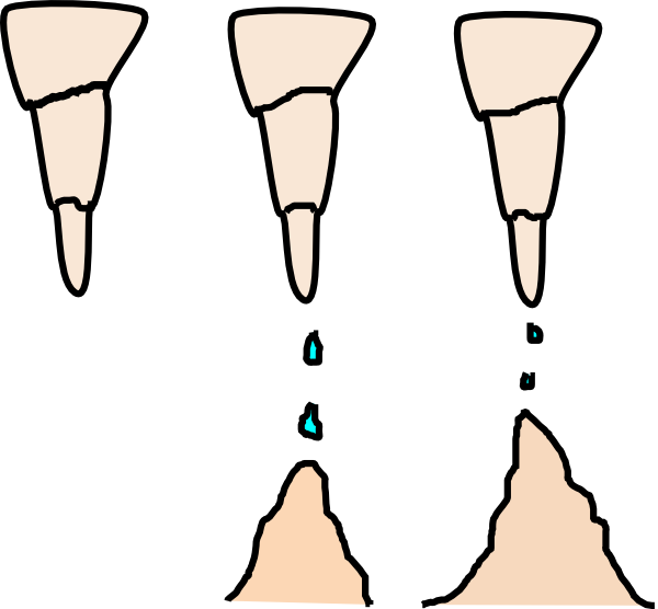 Stalactite And Stalagmite Clip Art At Clker - Stalactites And Stalagmites Clipart (600x556)