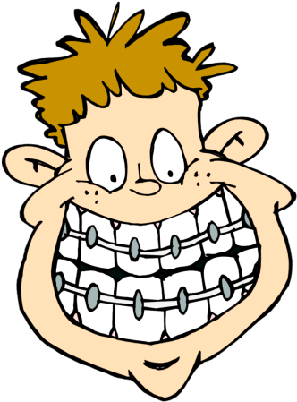 Braces Cliparts - Braces Cartoon (350x465)