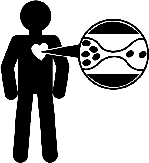 Diabetes - Heart (565x598)