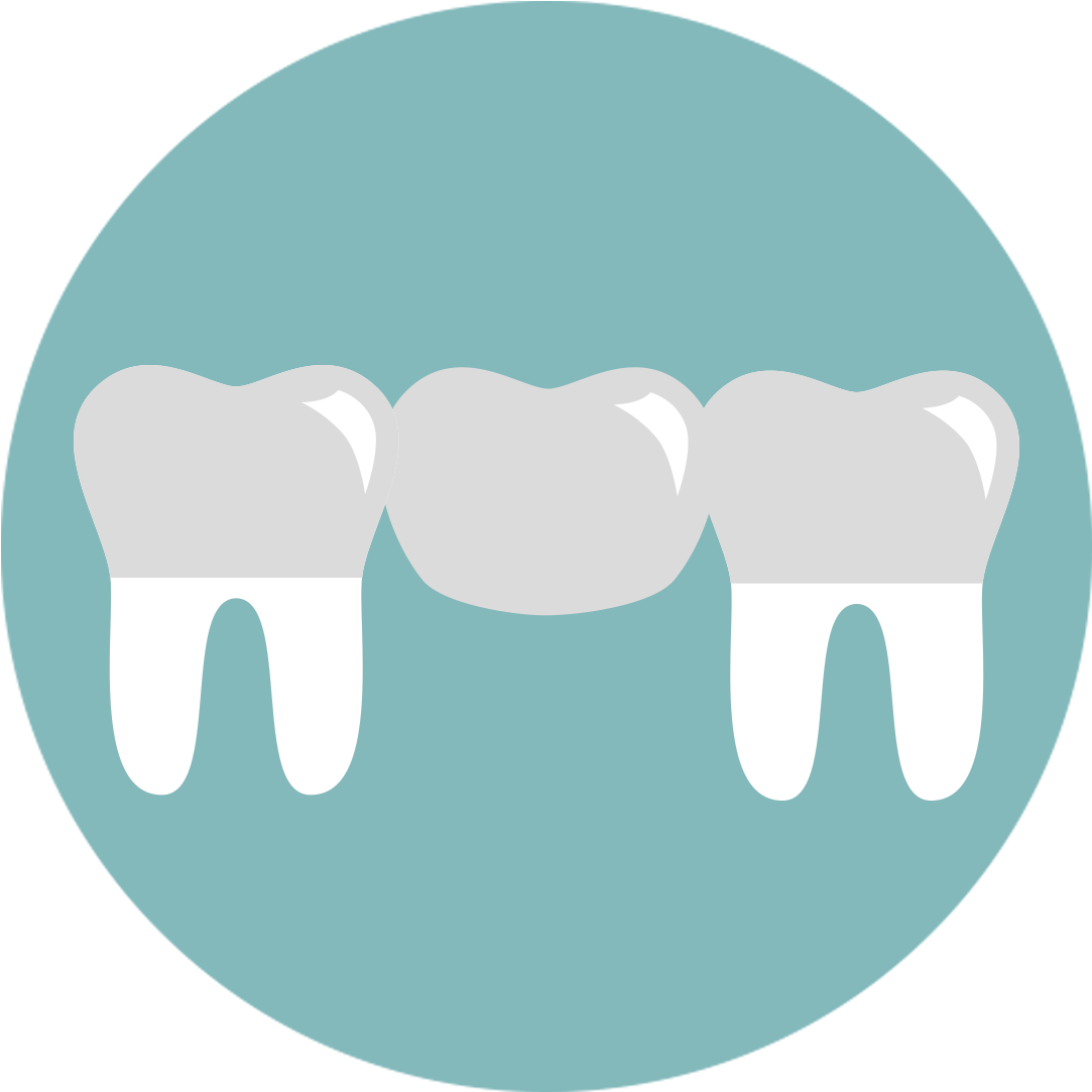 A Bridge Is One Method To Replace Missing Teeth, And - Angel Tube Station (1096x1096)