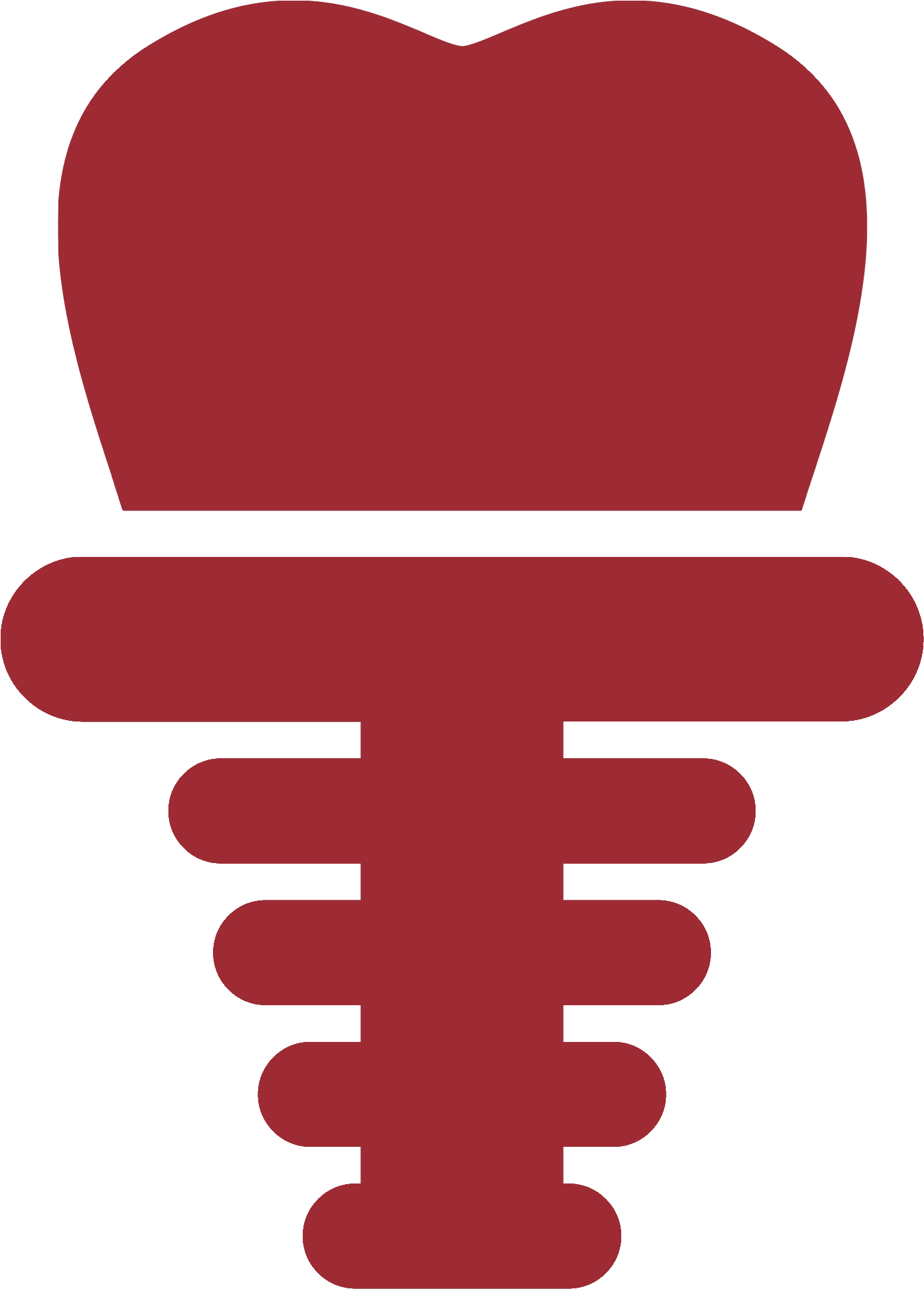 Dental Implants - Dental Implant (1416x1973)