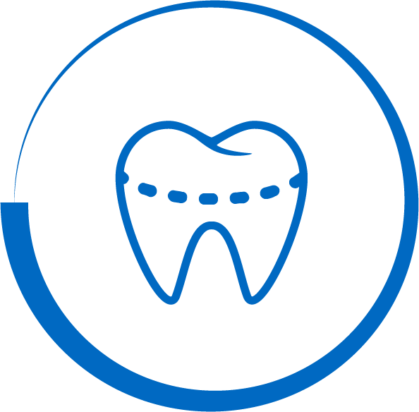 Dental Crowns - Root Canal Treatment Symbol (594x584)