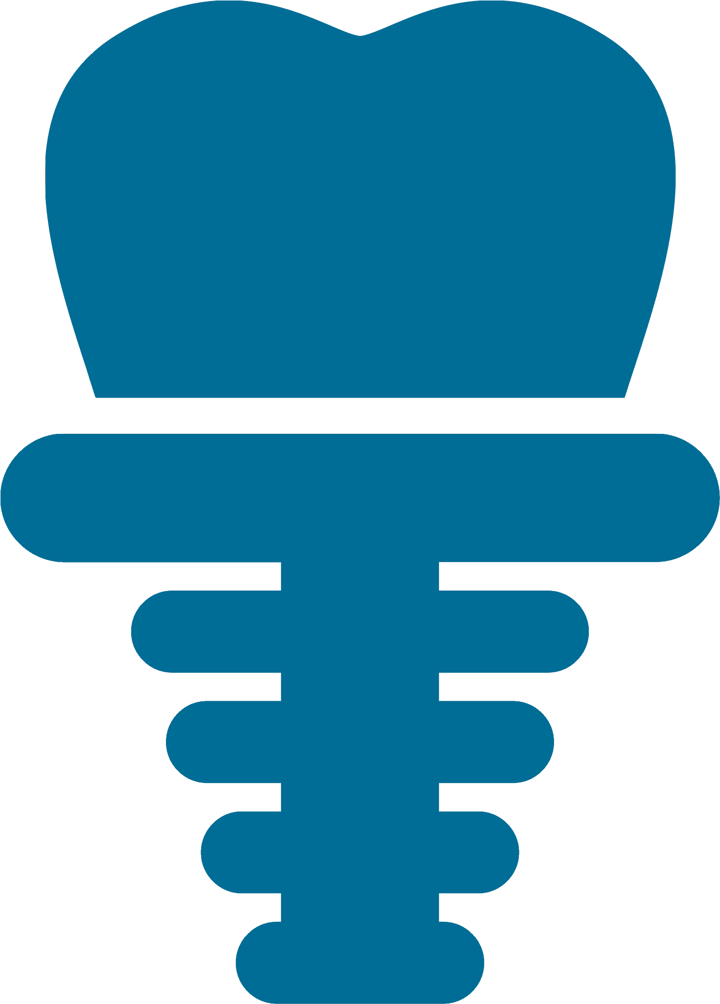 Dental Implants - Tooth (1416x1973)