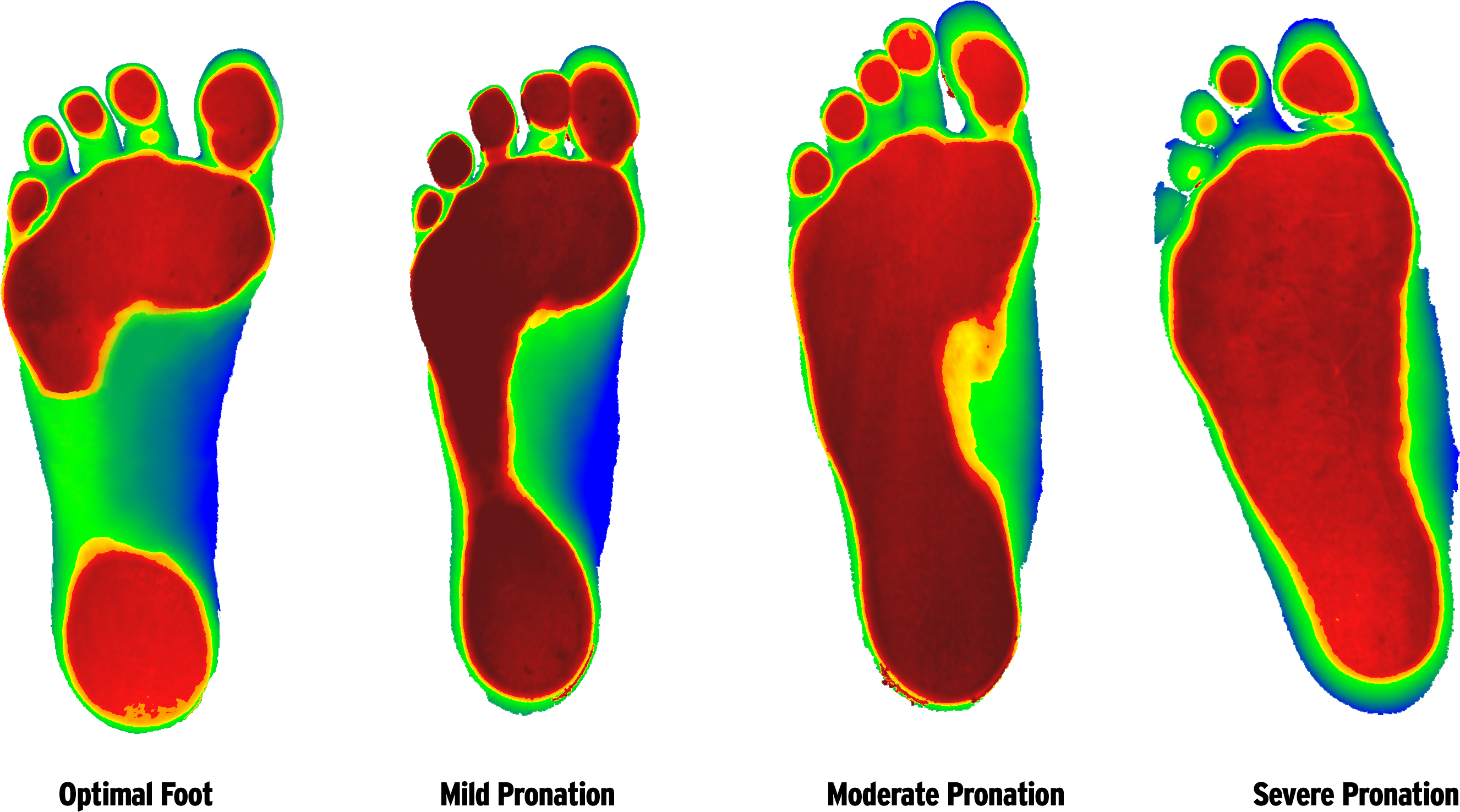Foot Types - Foot Levelers (3072x1750)