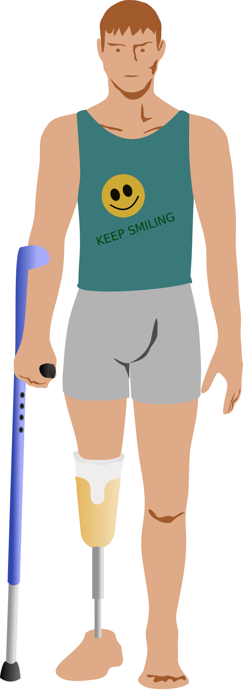 Big Image - Amputation Clipart (847x2400)