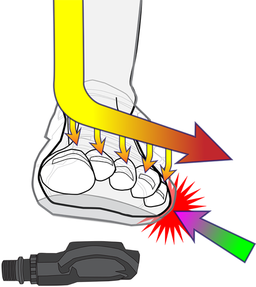 Cleat Wedges® Enable The Cycling Shoe To Connect With - Cycling Foot Pain Outside (520x582)