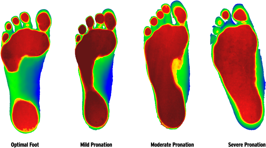 Trade In Pain, Pills And Missed Work For Chiropractic - Foot Levelers (1000x570)