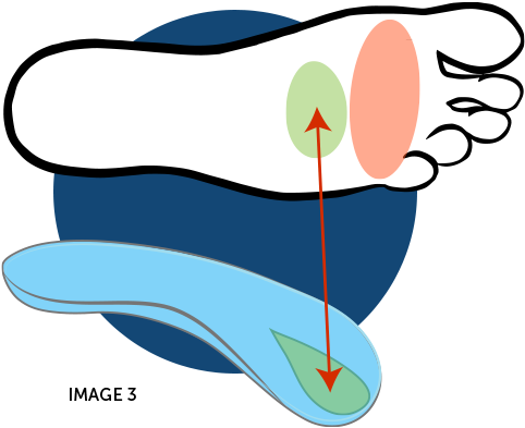 Ball Of Foot Pain Illustration Step - Podalgia (600x420)