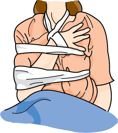 First Aid For Arm Fractures (377x426)