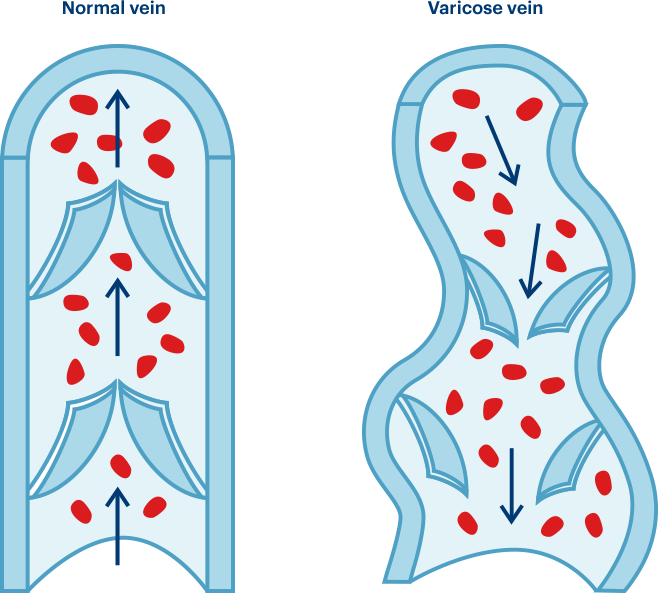 Comparaison Comparaison - Simile (658x593)