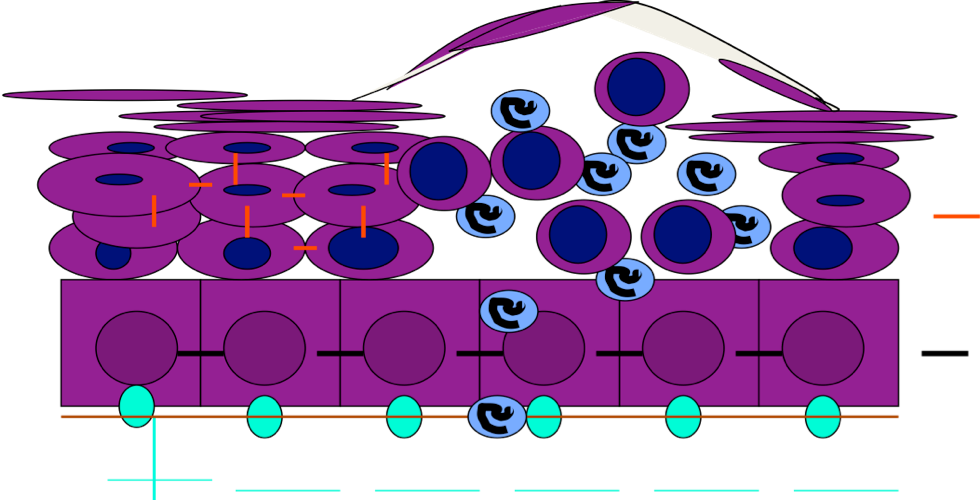 Der Pemphigus Foliaceus Ist Die Häufigste Pemphigusform - Circle (980x500)