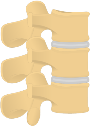 Lumbar Vertebrae - Articulated View - Lumbar Vertebrae (745x550)