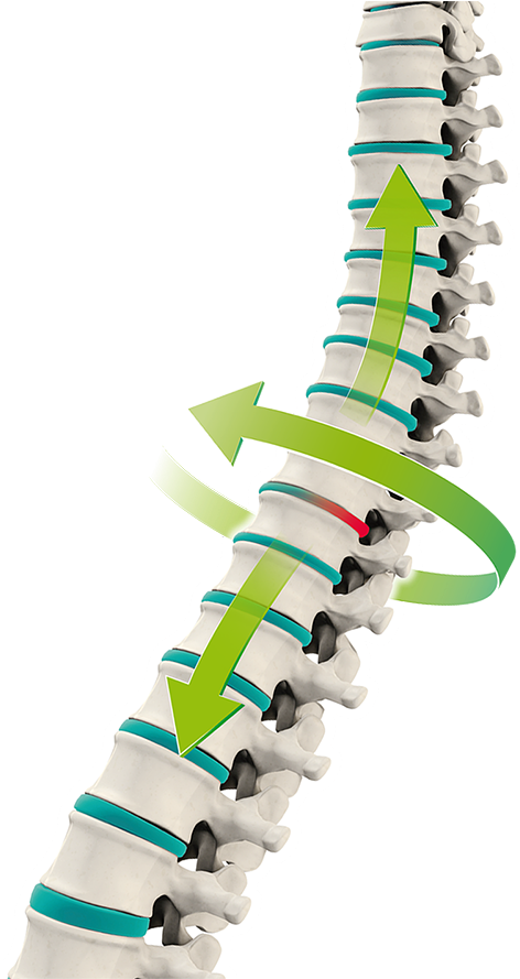 3d Range Of Motion Combined With Kinetic Decompression - Illustration (500x888)