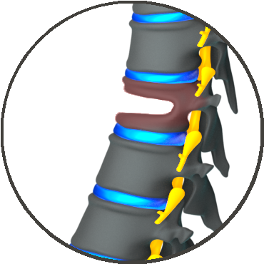 Compound Bow (395x389)