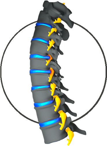 Cervical Myelopathy - Insect (395x561)