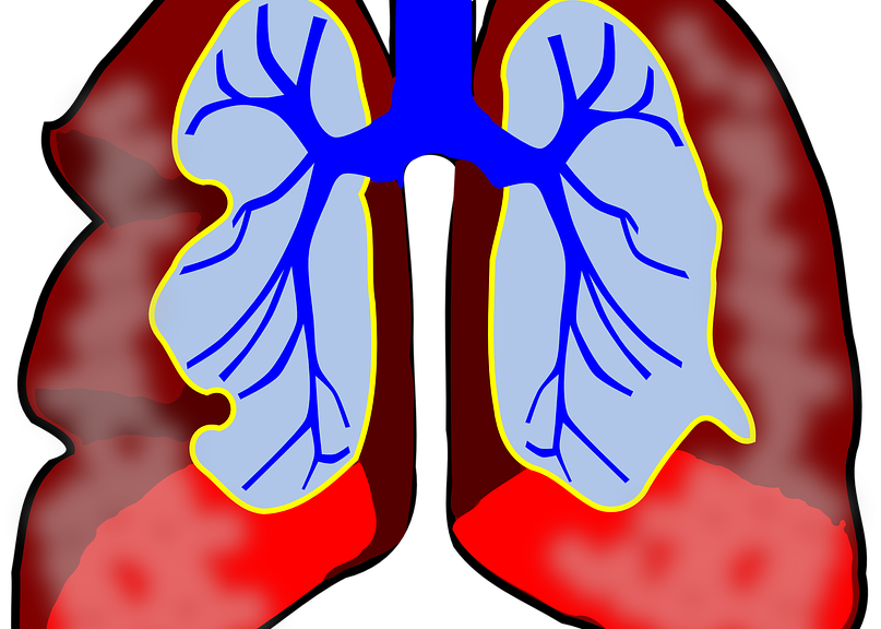 How To Become A Respiratory Therapist For Air Ambulances - Differences Between An Inspiratory And Expiratory Wheeze (807x576)