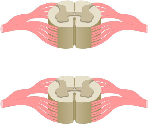 Cross Section Of The Spinal Cord Showing 2 Lumbar Segments, - Central Canal Spinal Cord (770x481)