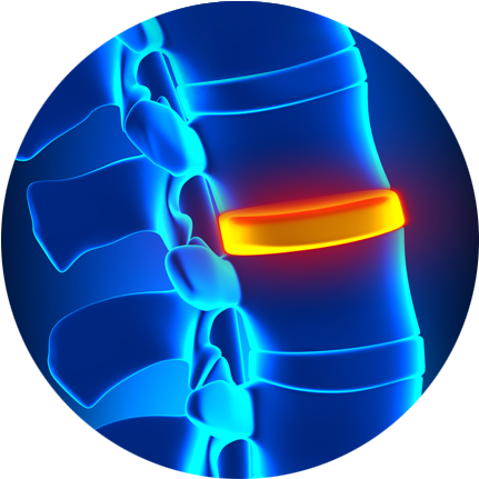 An Error Occurred - Sindrome De Cauda Equina (450x450)