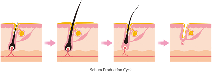 When You Wash Your Hair Using A Product To Dry Out - Sebum Production (836x291)
