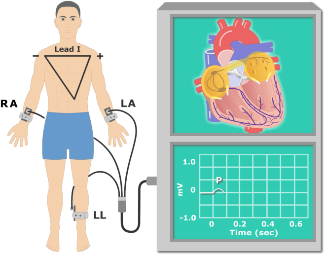 The P Wave Ekg Recording Animation Slide - Ekg Animation (666x550)